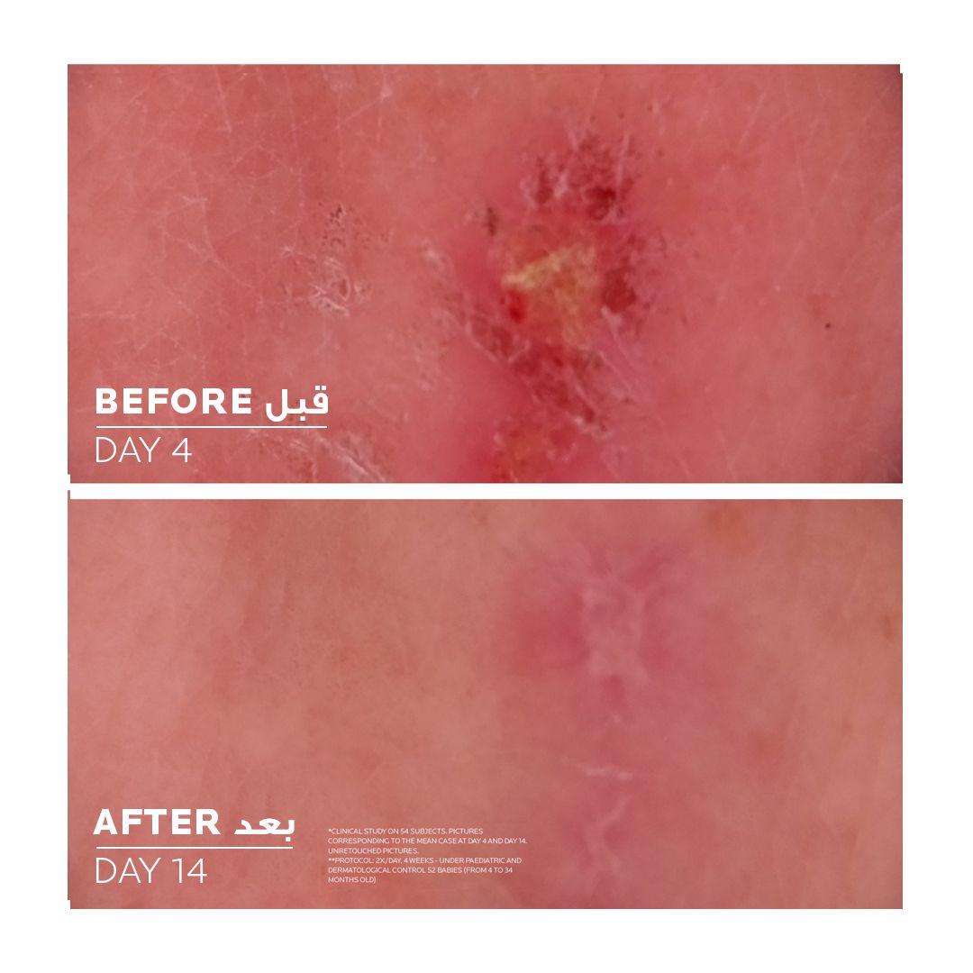 La Roche-Posay Cicaplast B5+ Repairing & Soothing Balm, 40ml product image 3