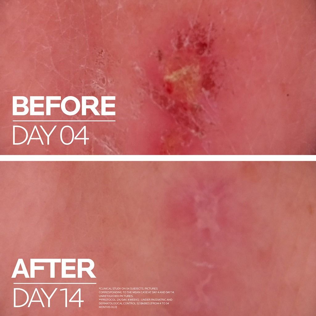 La Roche-Posay Cicaplast Baume B5 Soothing & Repairing Balm for Babies with Sensitive Skin, 100ml product image 5