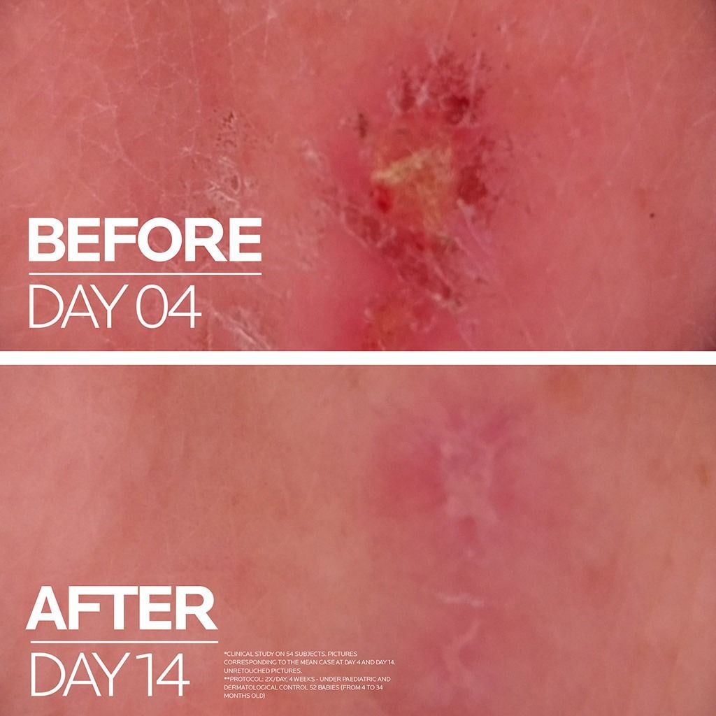 La Roche Posay Cicaplast Baume B5+ 40ml product image 3
