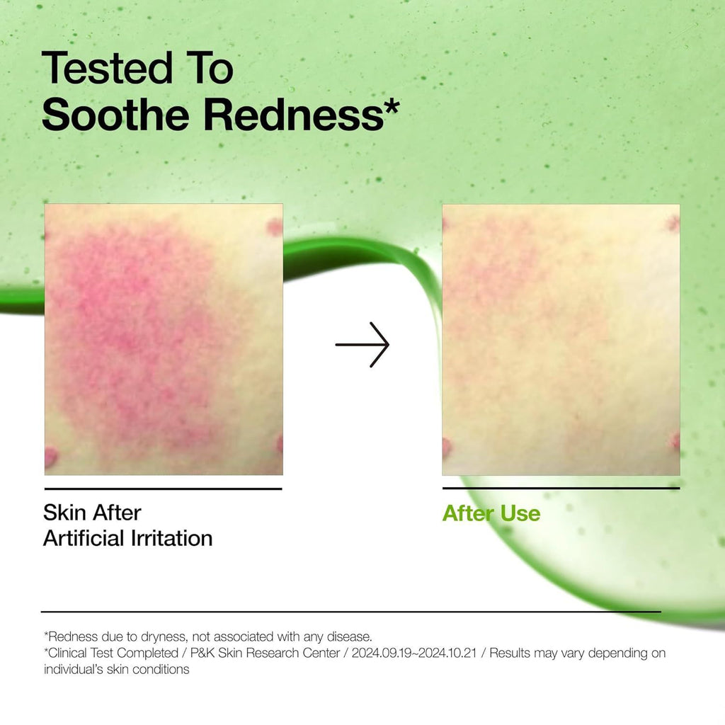 Anua Azelaic Acid 10 Hyaluron Redness Soothing Serum 30ml product image 4