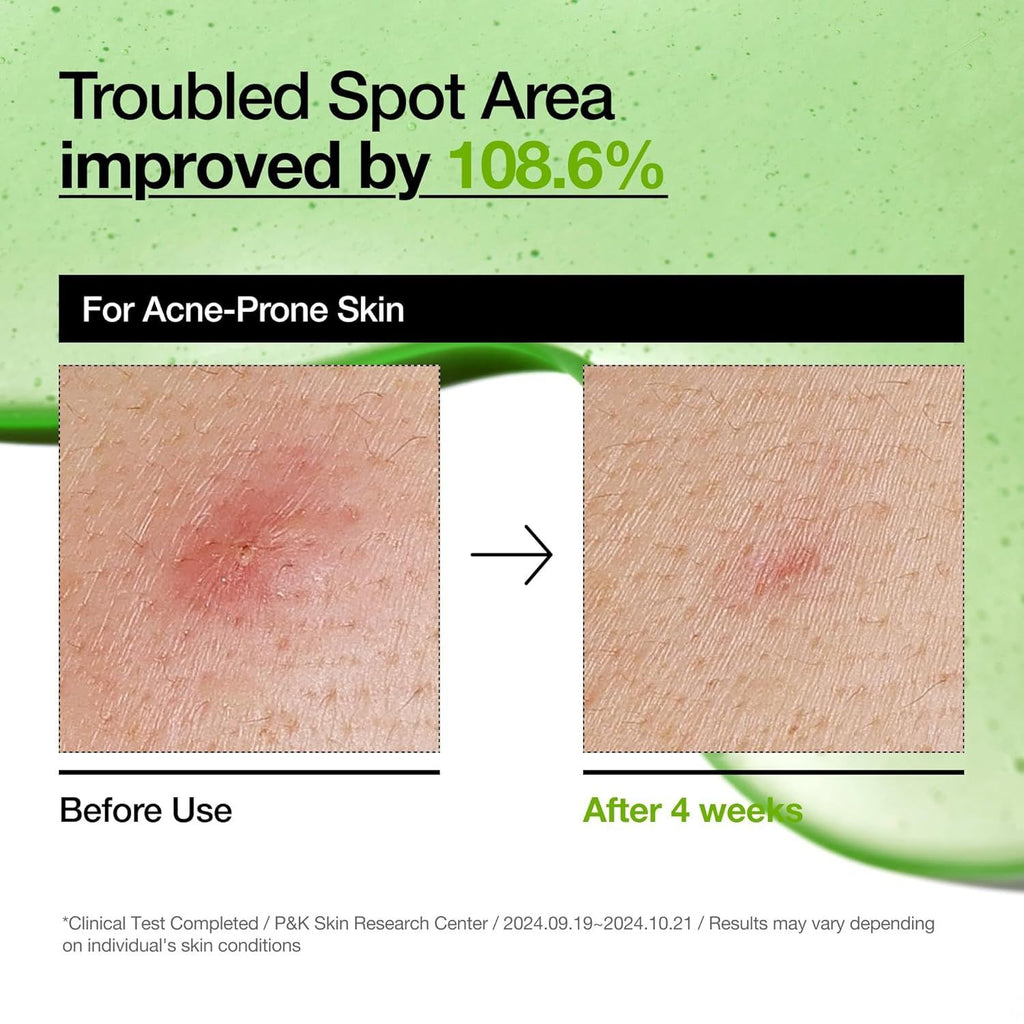 Anua Azelaic Acid 10 Hyaluron Redness Soothing Serum 30ml product image 5