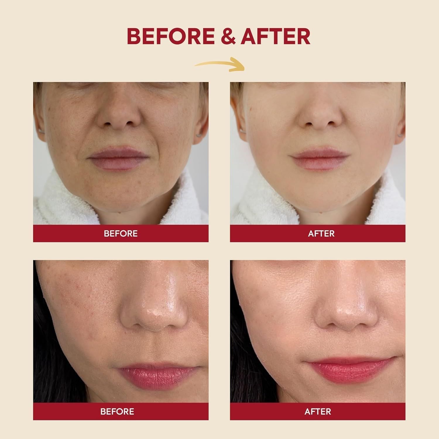 K-secret Seoul 1988 Essence Snail Mucin 97% + Rice, 100ml product image 4