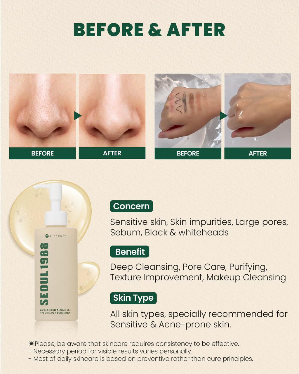 K-secret Seoul 1988 Pine Cica 1% + Probiotics Cleansing Oil, 200ml product image 5