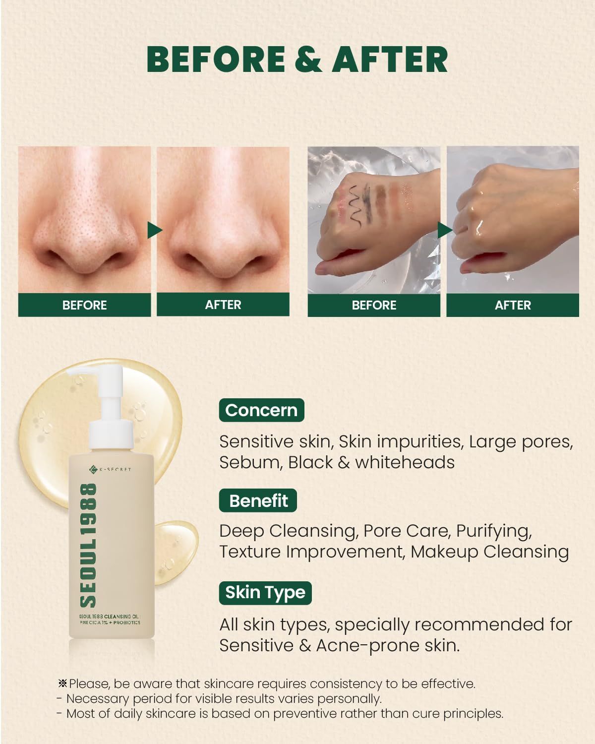 K-secret Seoul 1988 Pine Cica 1% + Probiotics Cleansing Oil, 200ml product image 5