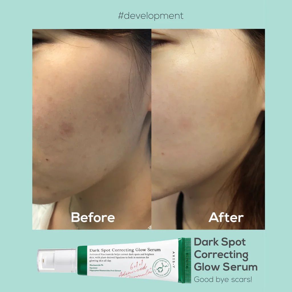 Axis-Y Dark Spot Correcting Glow Face Serum with Niacinamide, Squalane & Fruit Extract, 50ml product image 4