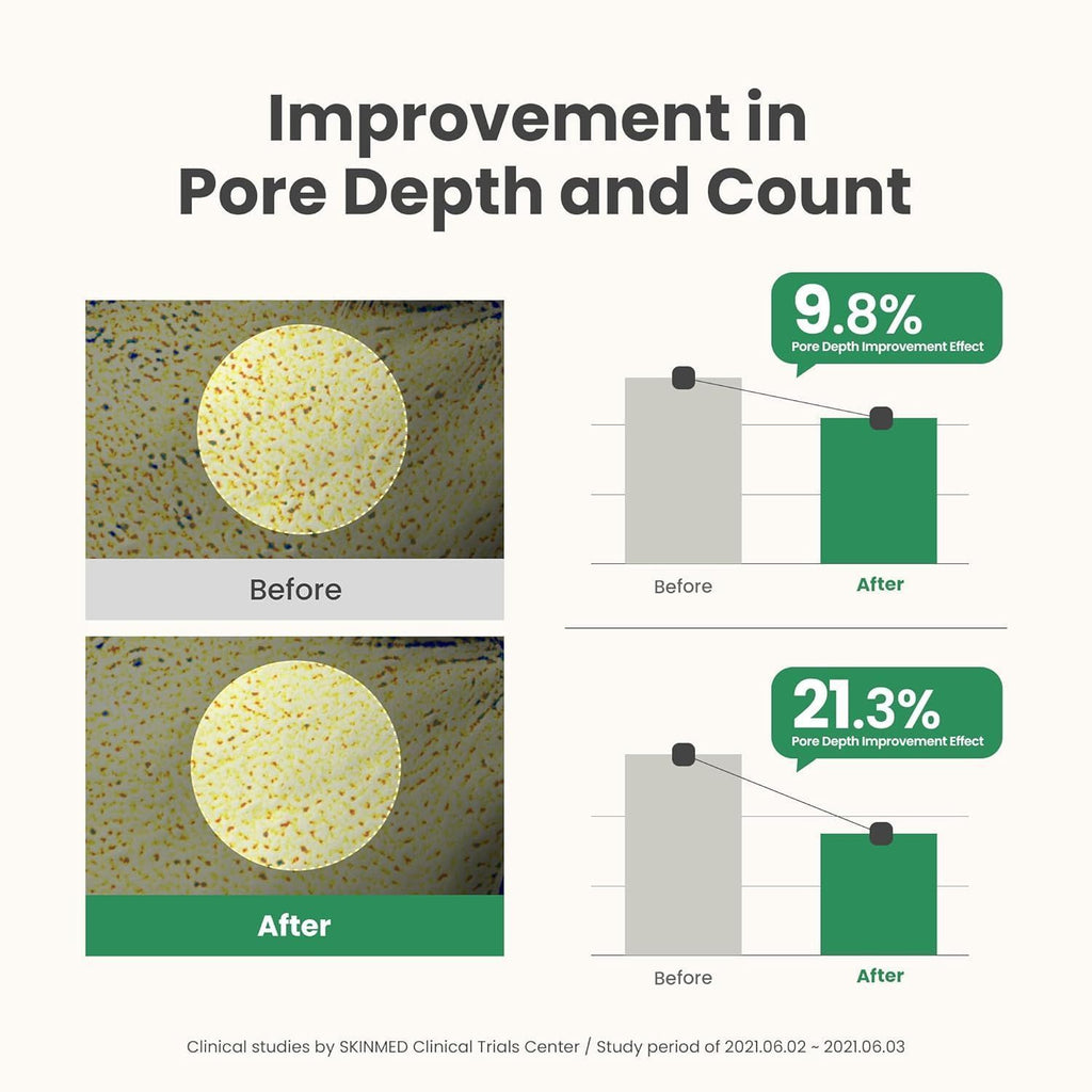 Axis-Y Mugwort Pore Clarifying Wash-Off Face Mask with Bean & Seaweed Extracts, 100ml product image 9