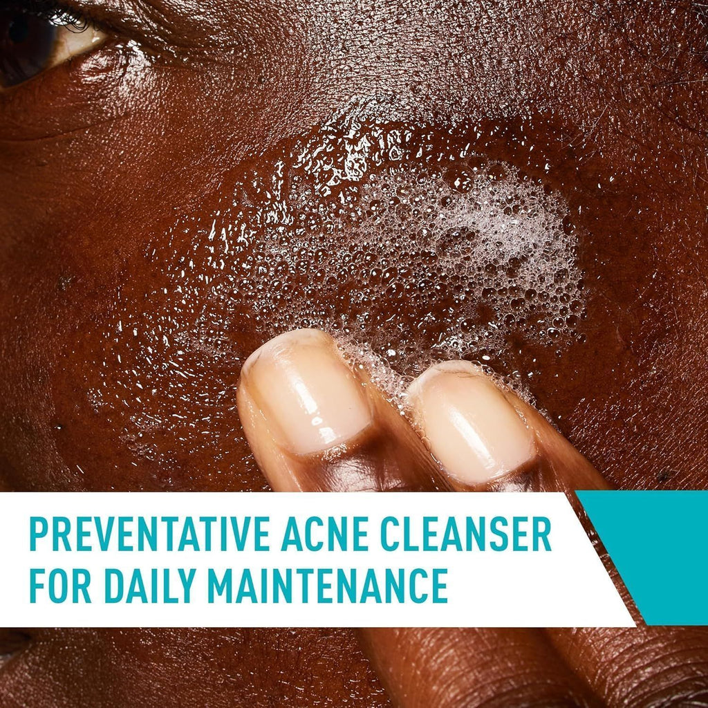 CeraVe Acne Control Facial Cleanser with Essential Ceramides, Hectorite Clay & Niacinamide, 237ml product image 5