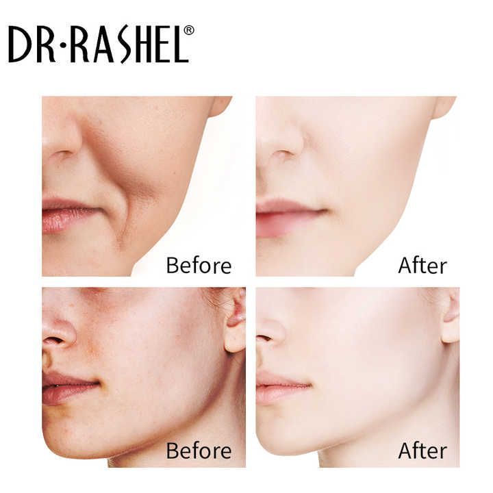 Dr. Rashel Complete Facial Serum Set, 1 bundle product image 4
