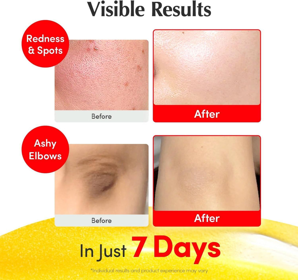 Eqqualberry Deep Cera Vitamin Illuminating Serum, 30ml product image 5
