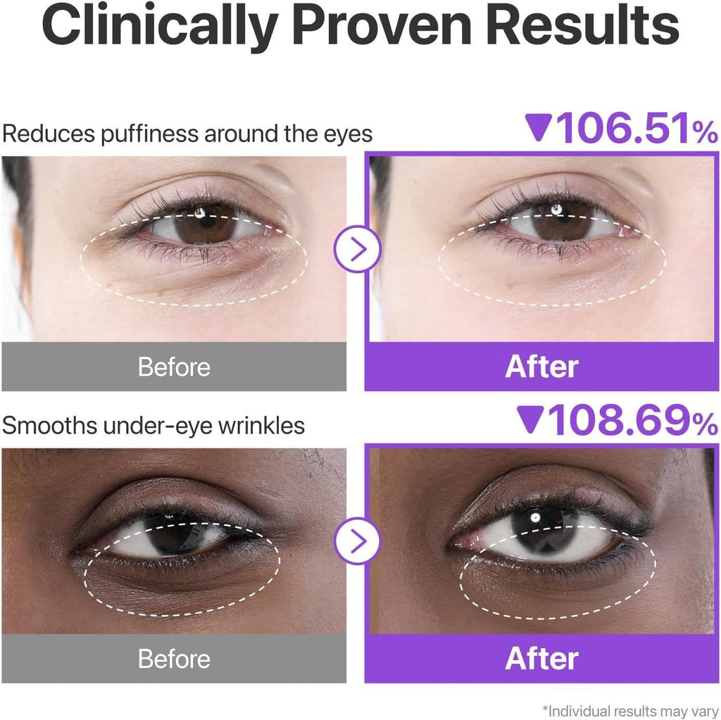 Numbuzin No. 9 NAD + Collagen Under Eye Patches, 5 Pairs product image 3