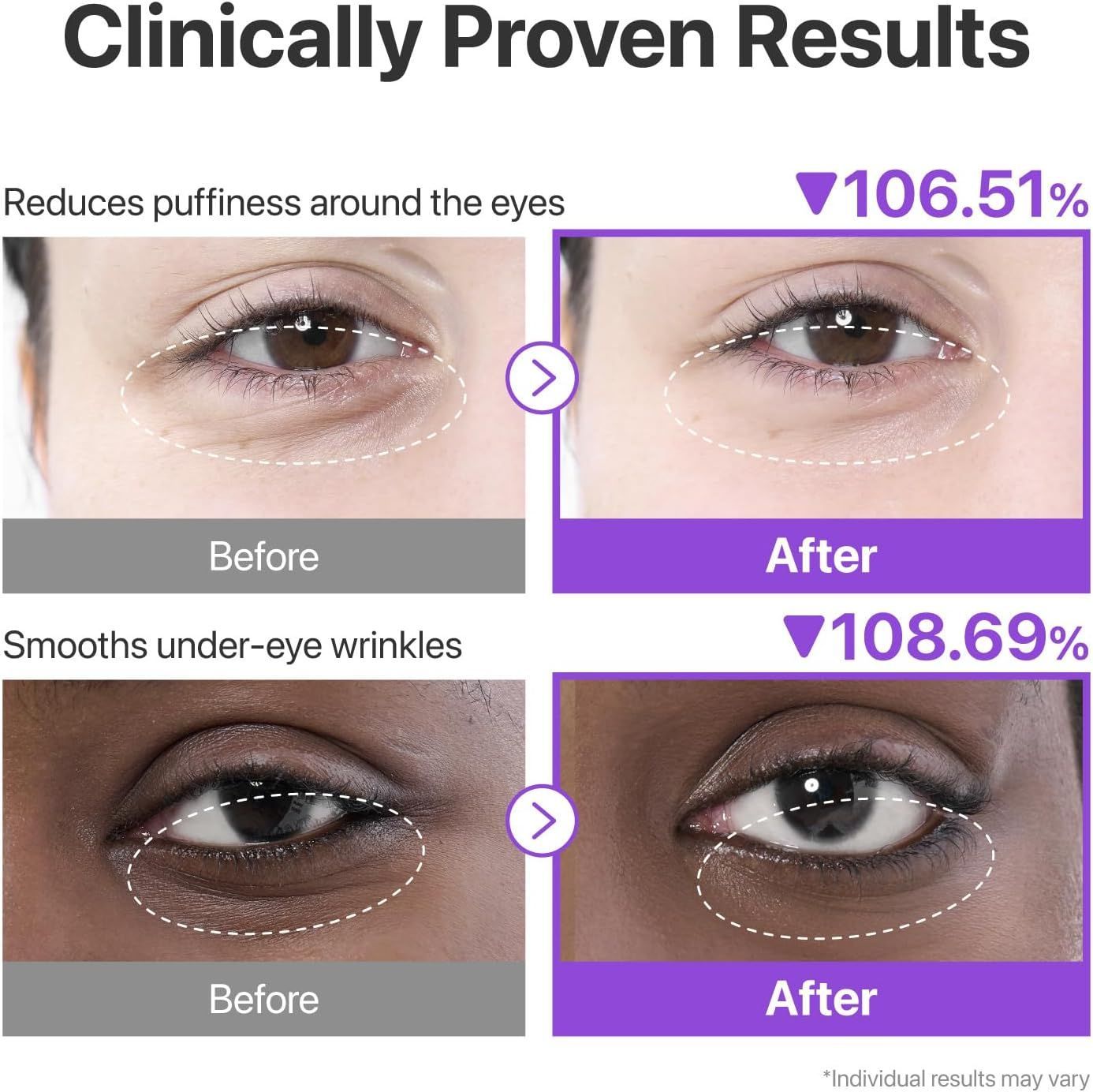 Numbuzin No. 9 NAD + Collagen Under Eye Patches, 5 Pairs product image 3