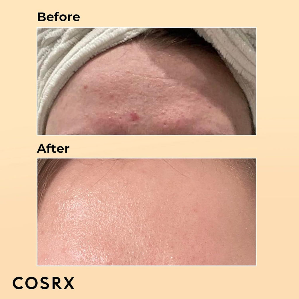 Cosrx Advanced Snail 96 Mucin Power Essence, 100ml product image 3